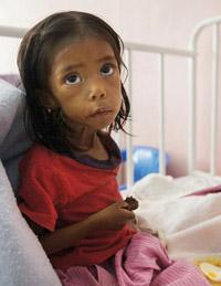 malnutrition_guatemala.jpg